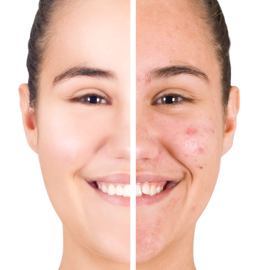 Rejuvenating Anti-Acne Organic Facial Scrub