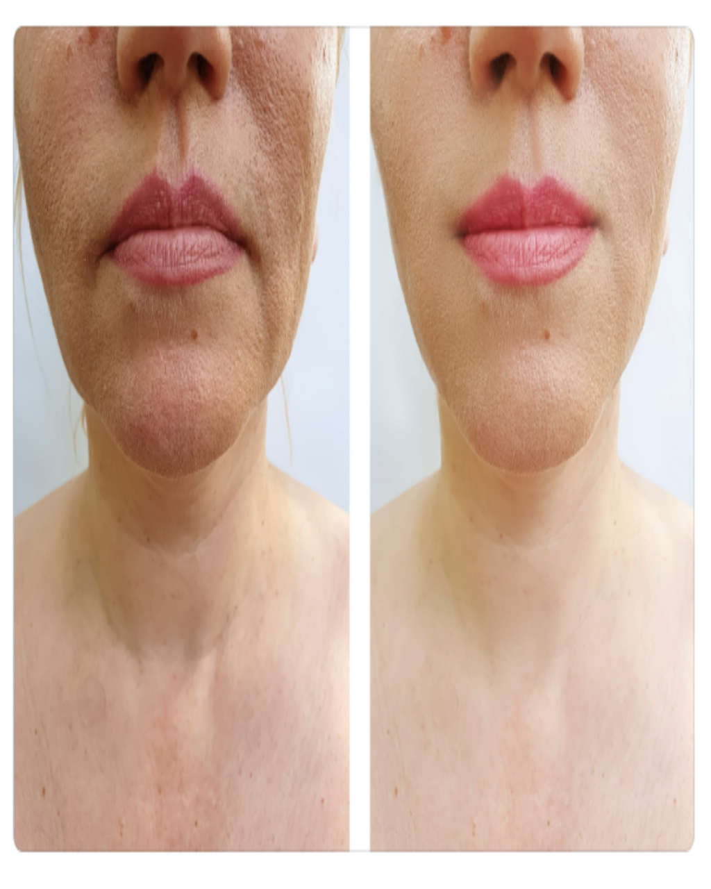 ORGANIC NECK RENEWAL CREAM - For Women