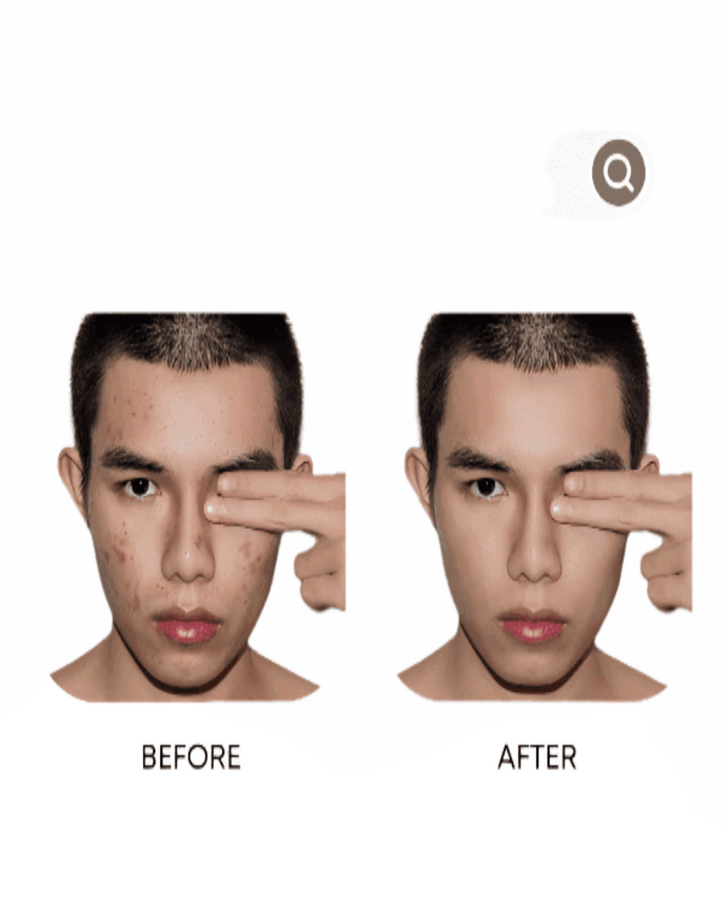 Anti-Acne Organic Facial Wash - For MEN